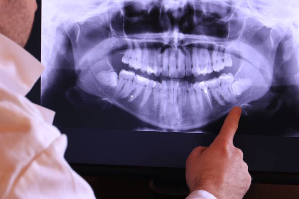 Best Tooth Pain Emergency Relief  in Flemington, GA