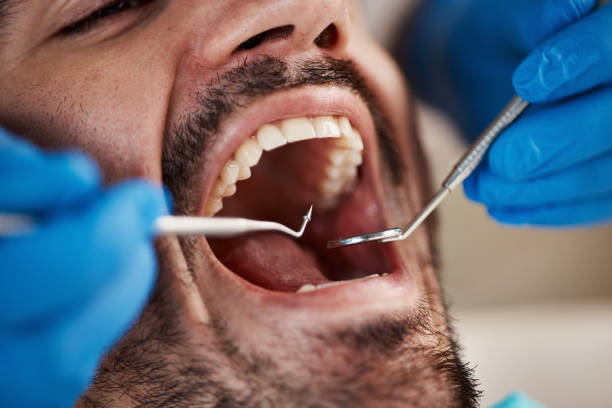 Best Chipped Tooth Repair Near Me  in Flemington, GA