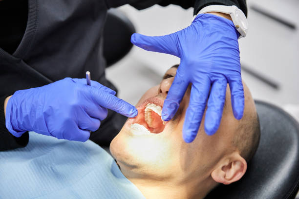 Best Dentist for Tooth Abscess  in Flemington, GA